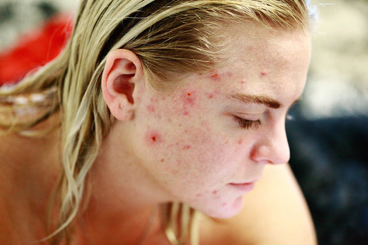 Skin Changes in Midlife: Why Your Skin Feels Different (and What You Can Do About It)